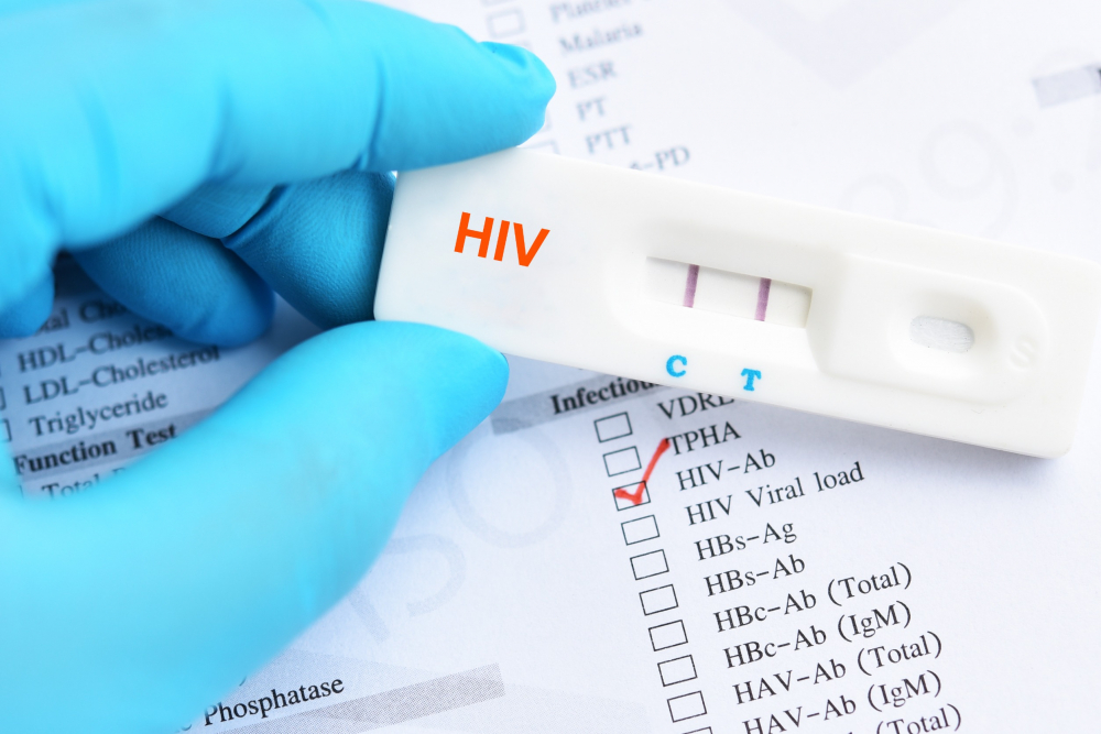 Shocking Truths About STD Testing: Symptoms, Hidden Dangers, and Why You Need to Know Now!