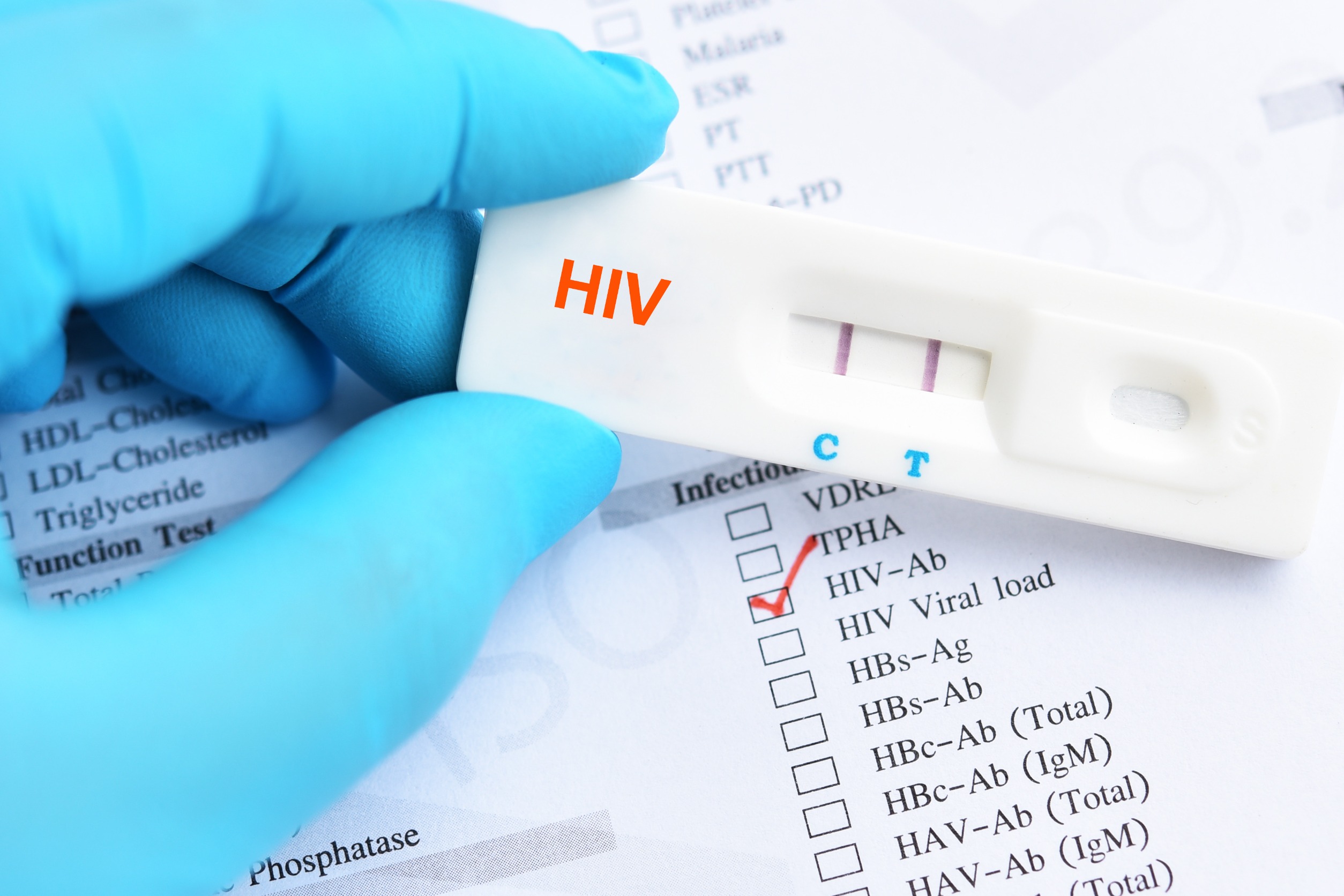 Shocking Truths About STD Testing: Symptoms, Hidden Dangers, and Why You Need to Know Now!