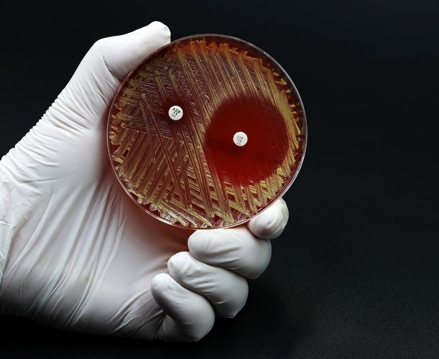 How Super Gonorrhoea Spreads (Even If You Use Protection)