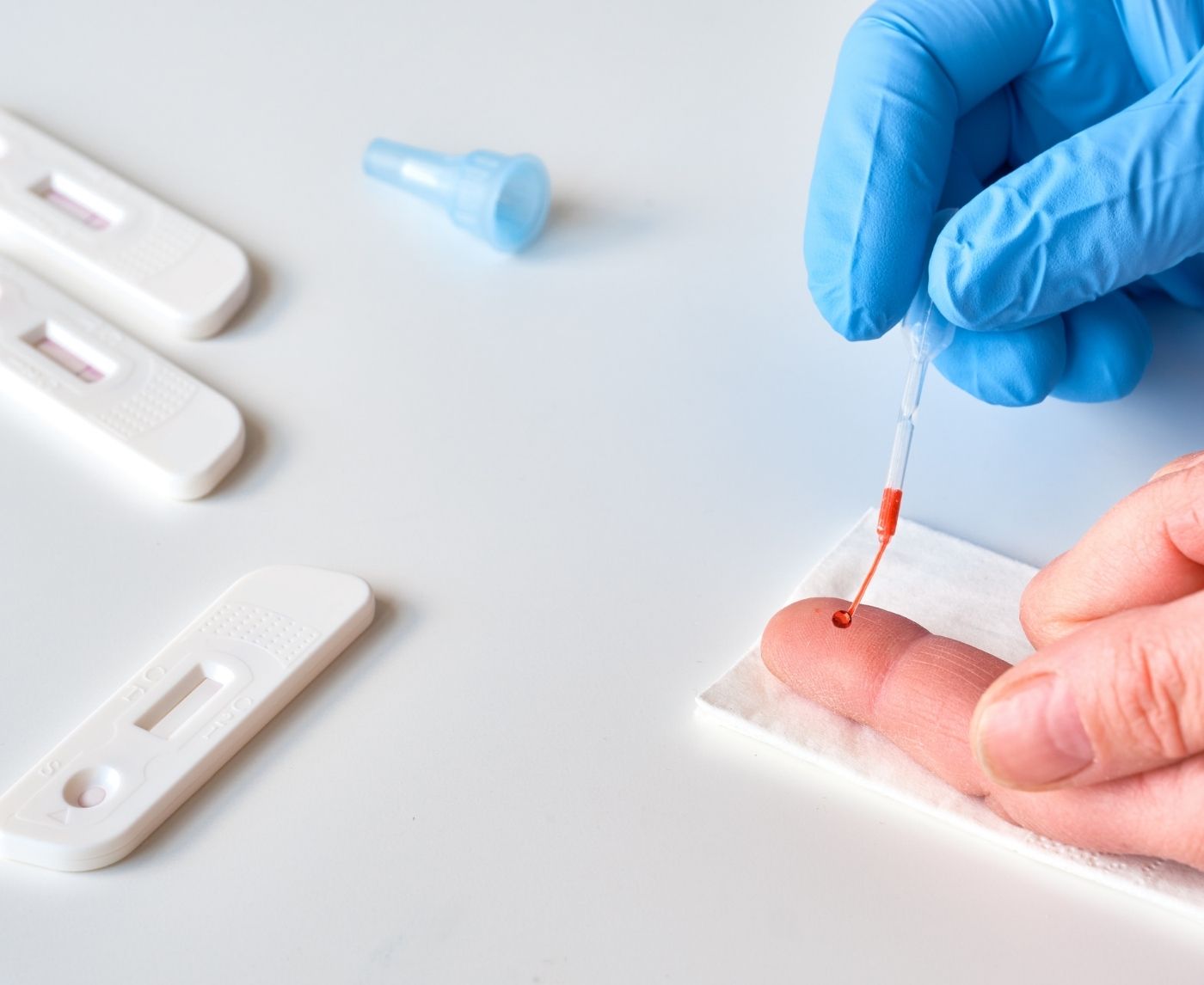 Swab vs Blood vs Urine STD Tests: What’s the Real Difference?