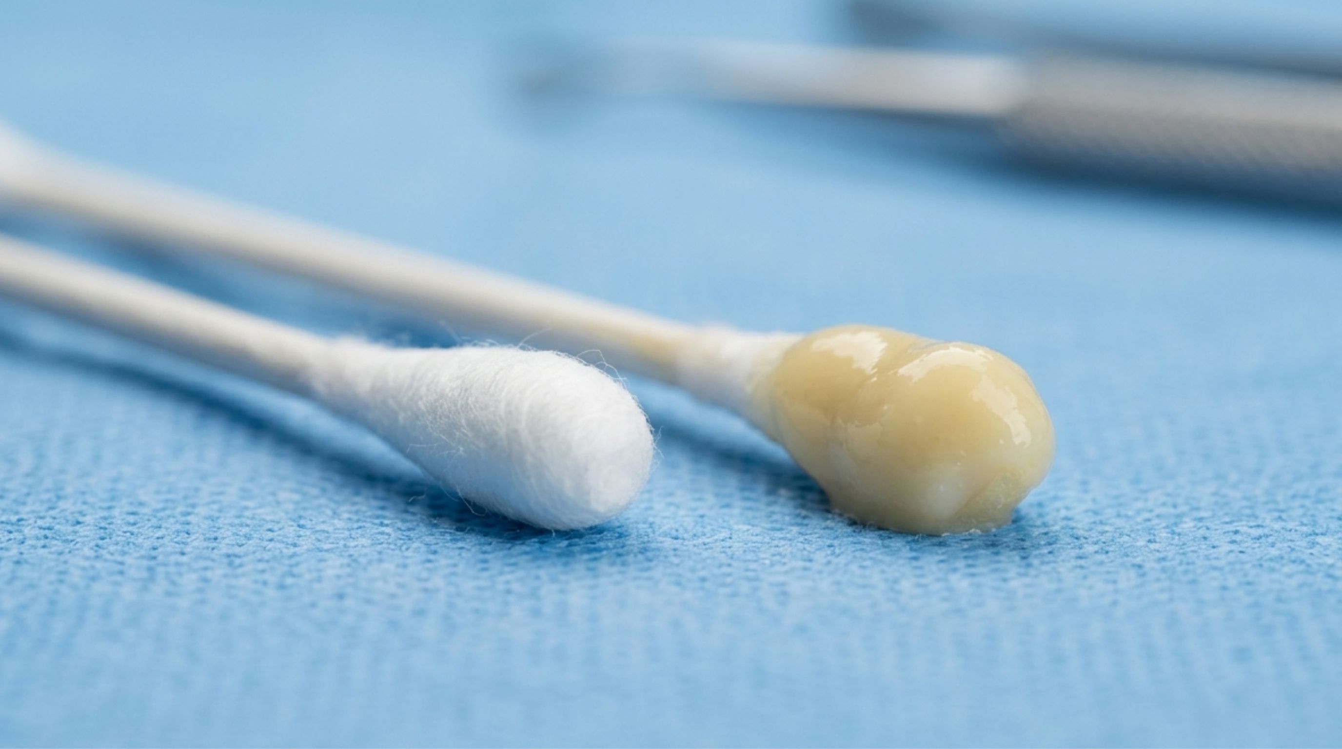 Is Discharge Without Pain a Sign of an STD?