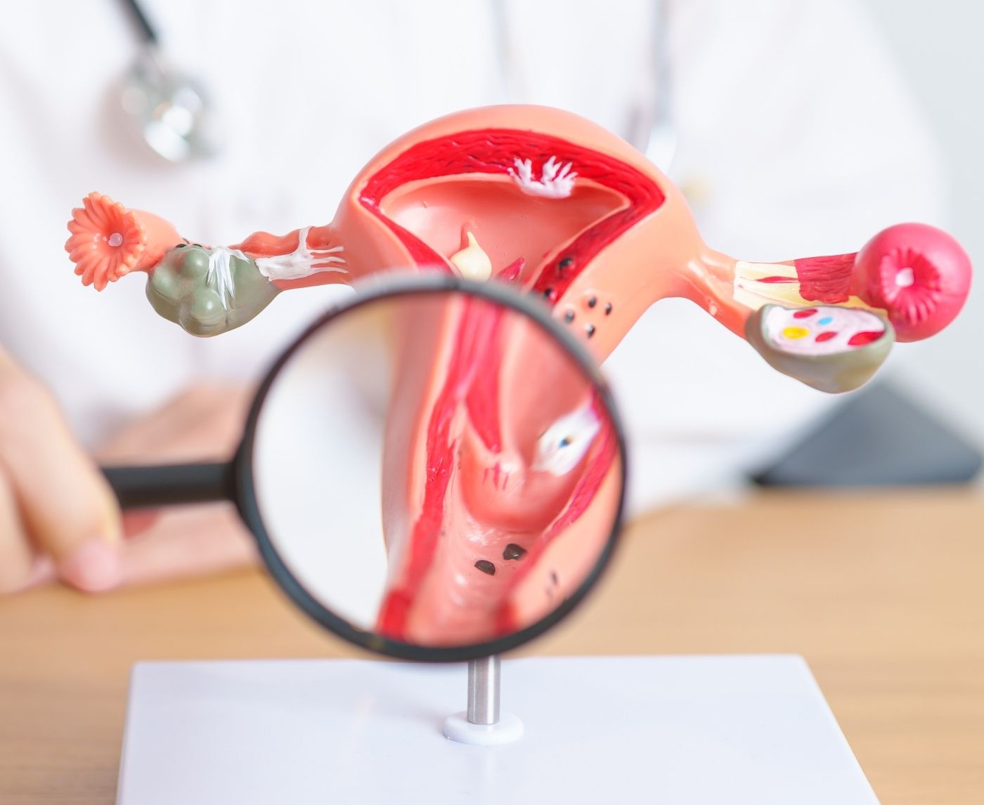 Why Your Endo Flares Might Be Worse With HIV (And What to Do About It)