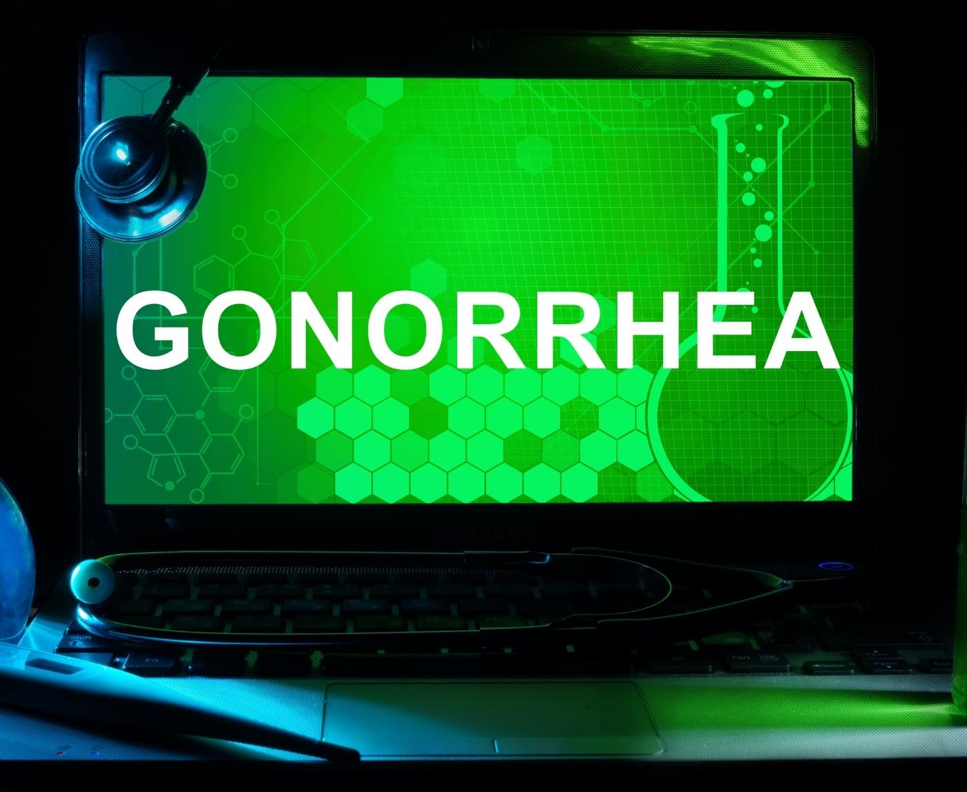 Positive Gonorrhea Test Line vs Negative: How to Read It