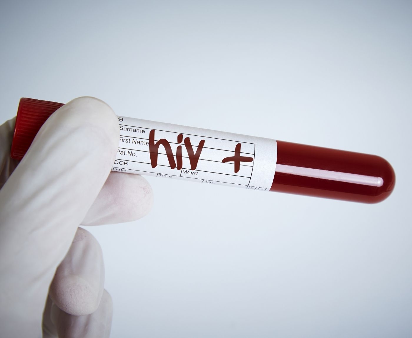 Florida’s HIV Crisis by the Numbers: Who’s Most at Risk and Why It’s Rising