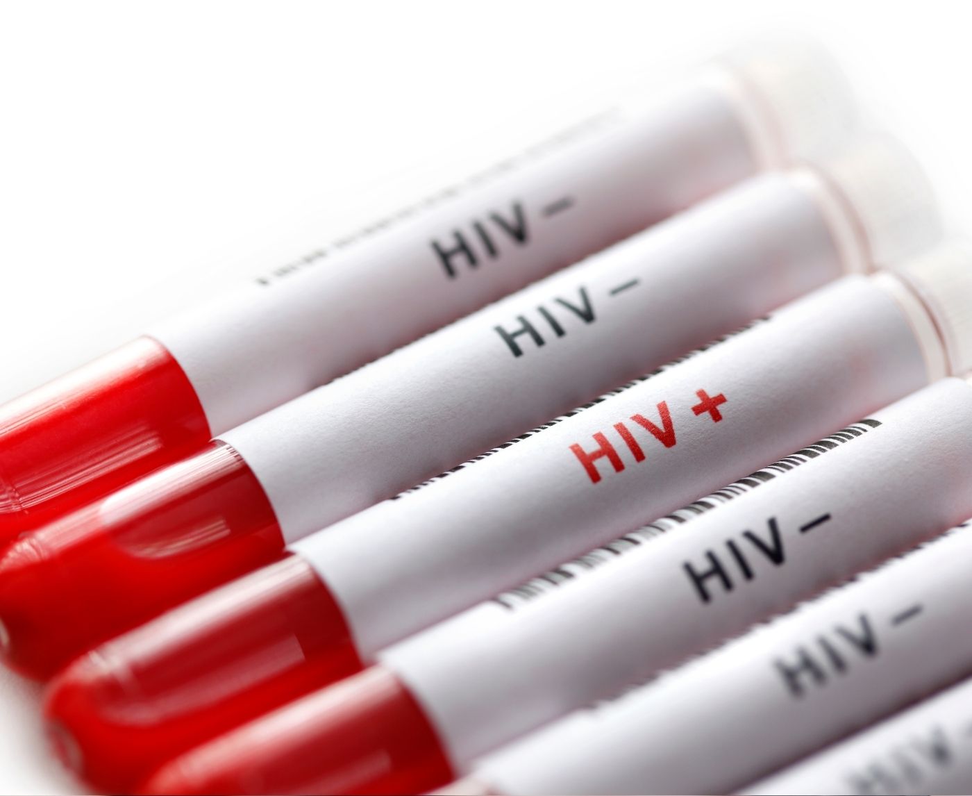 The 4 Stages of HIV: Symptoms, Timelines, and What Comes Next