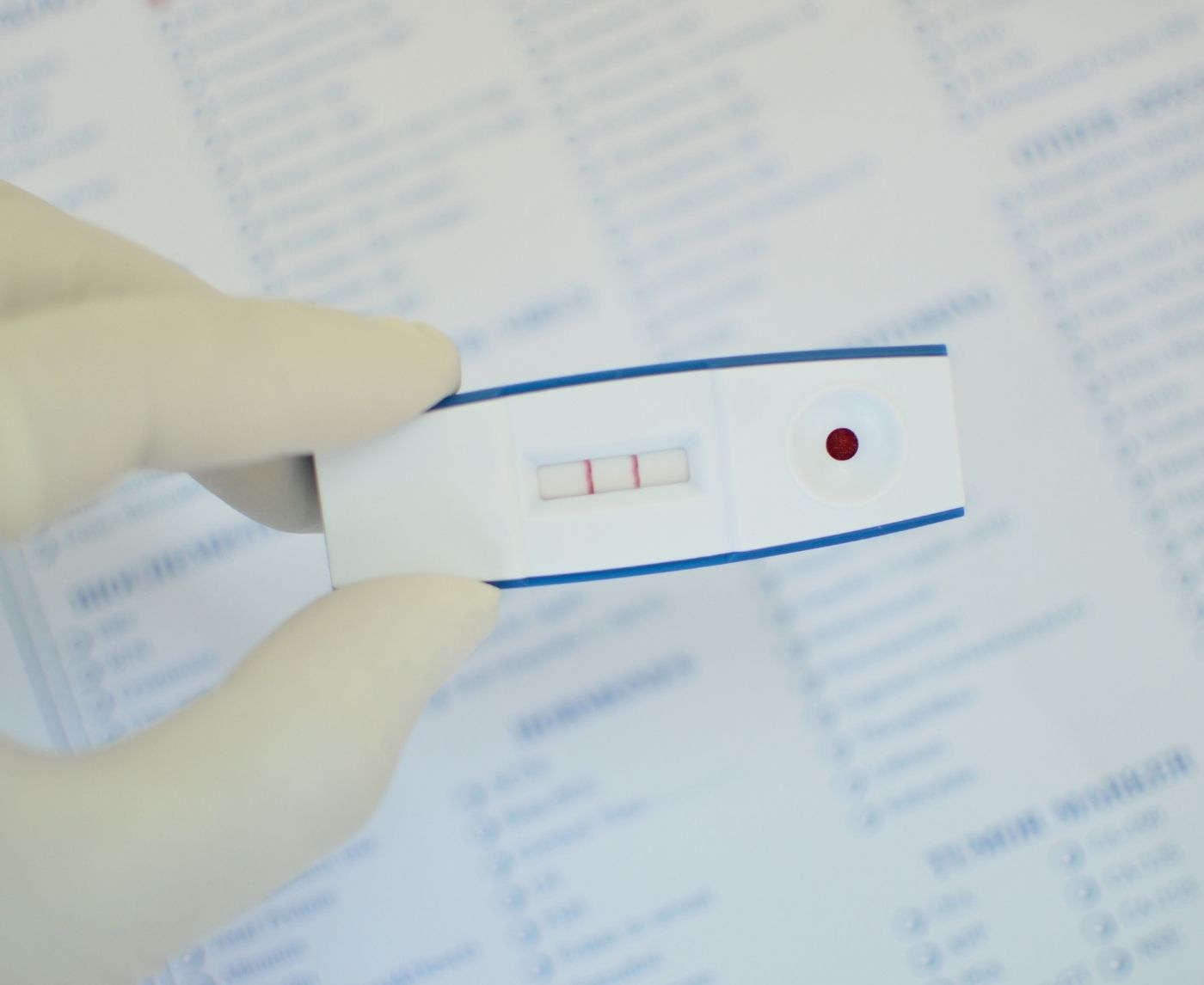 HIV Rapid Test Errors and Faint Lines: How to Know What’s Real