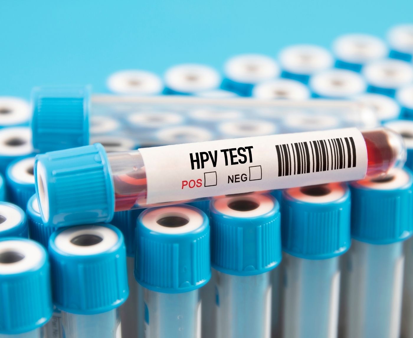 When Is the Right Time to Get Tested for HPV?
