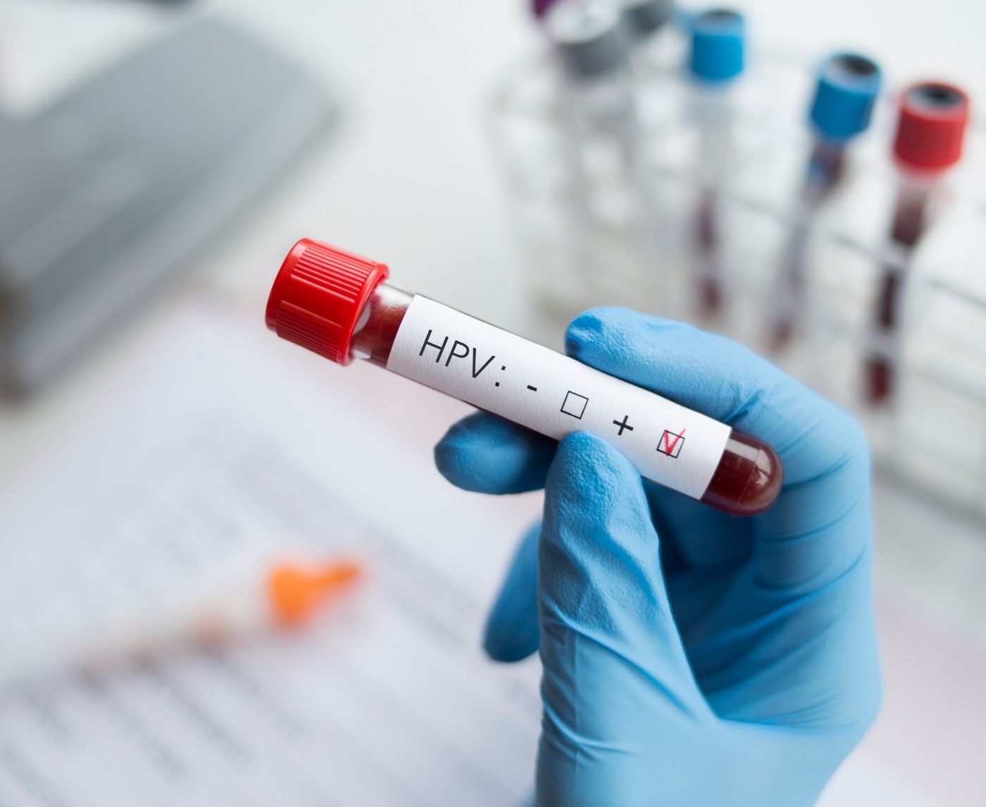 When to Test for HPV After Exposure (Men vs Women Guide)