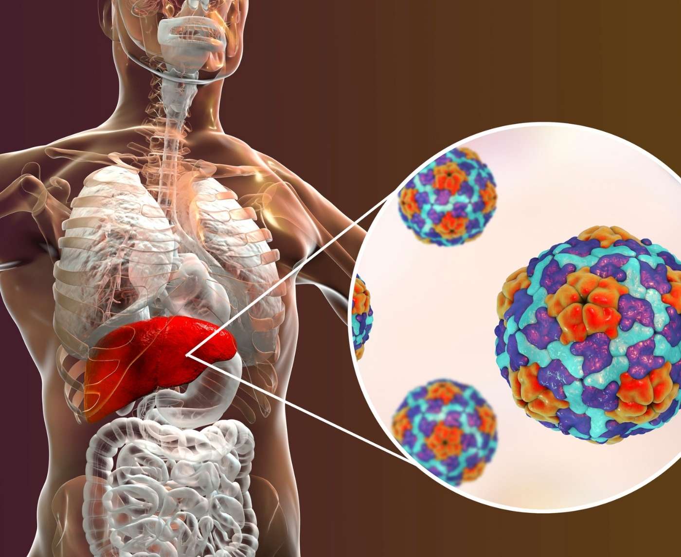 I Thought I Got Tested for Everything, Turns Out I Didn’t