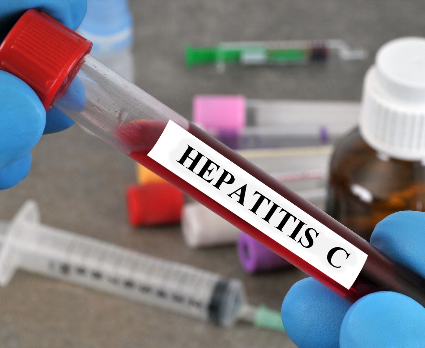 Thought It Was Fatty Liver. It Was Hepatitis C.