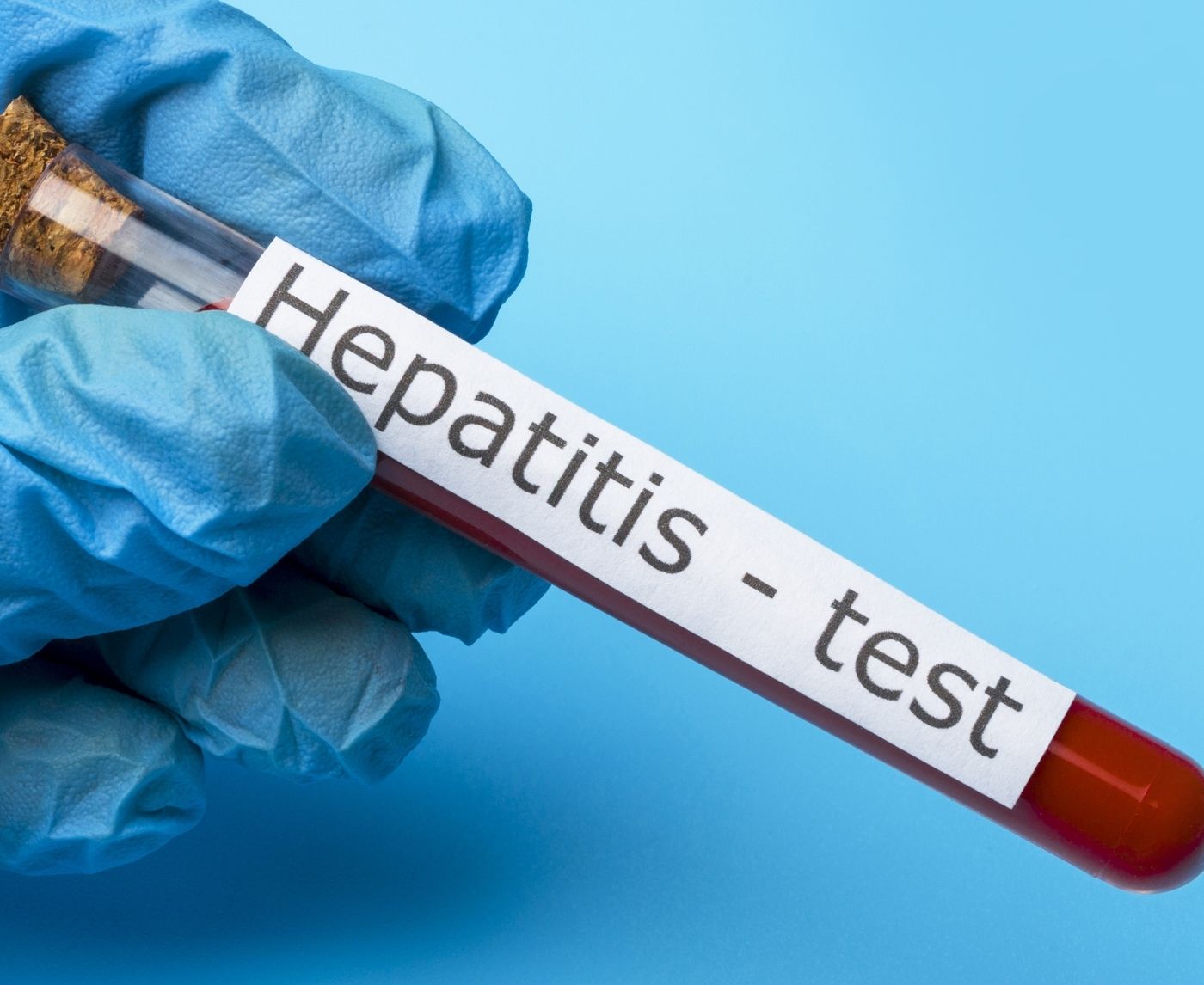 Can You Get Hepatitis B From Oral Sex? Yes, and Here’s How.