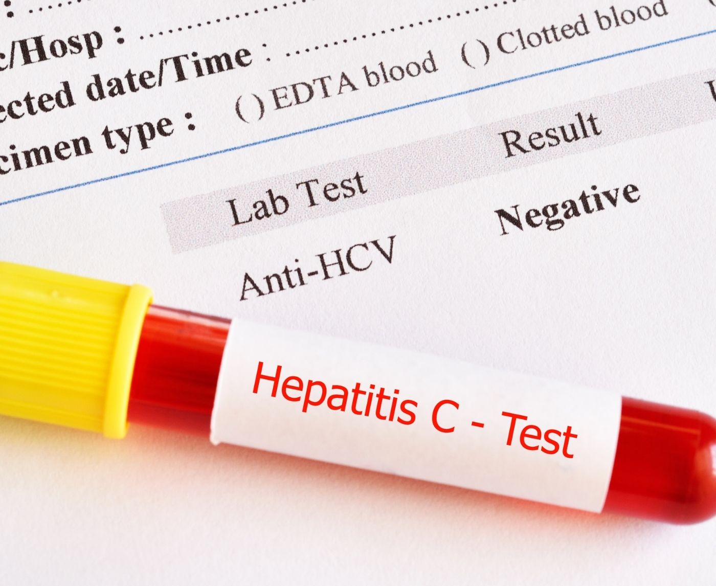 Which Hepatitis C Home Test Should You Trust in 2026?
