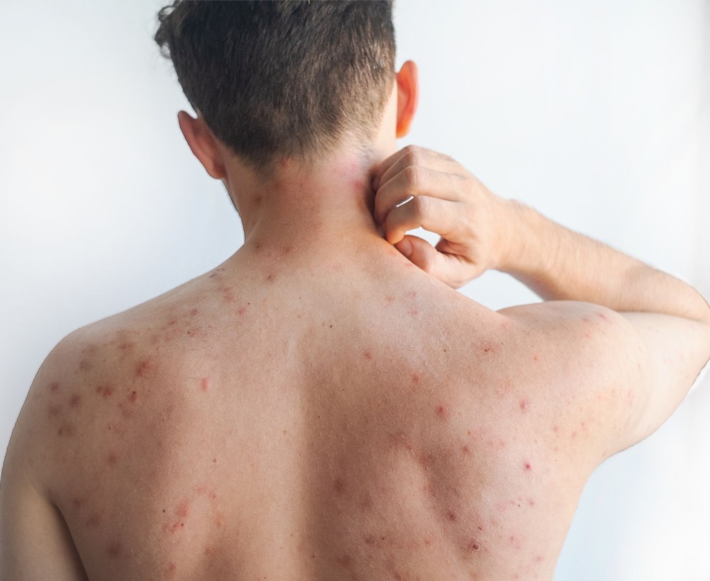 STD Symptoms in Men That Don’t Involve the Penis