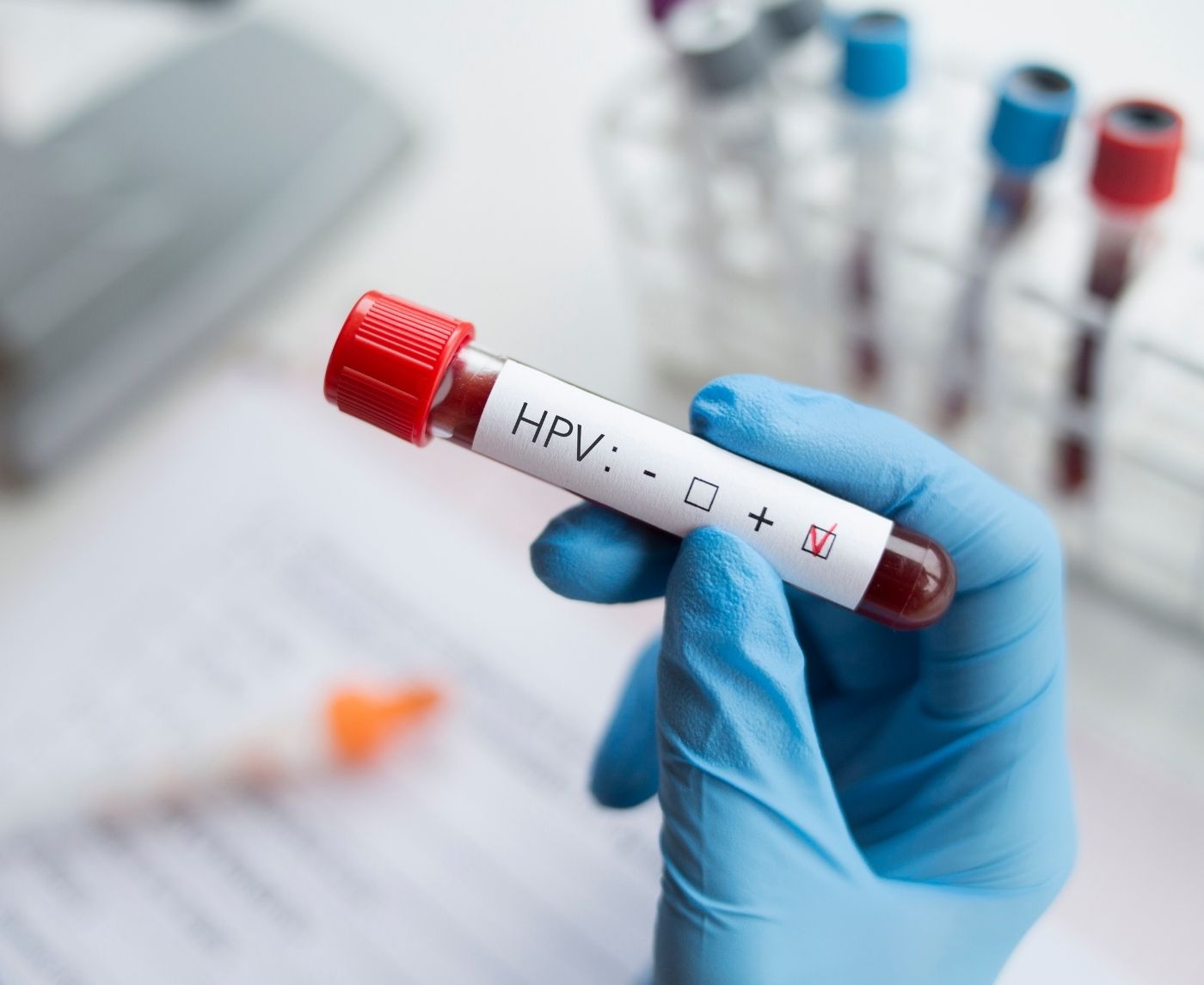 Still Positive for HPV After 2 Years? You’re Not Alone