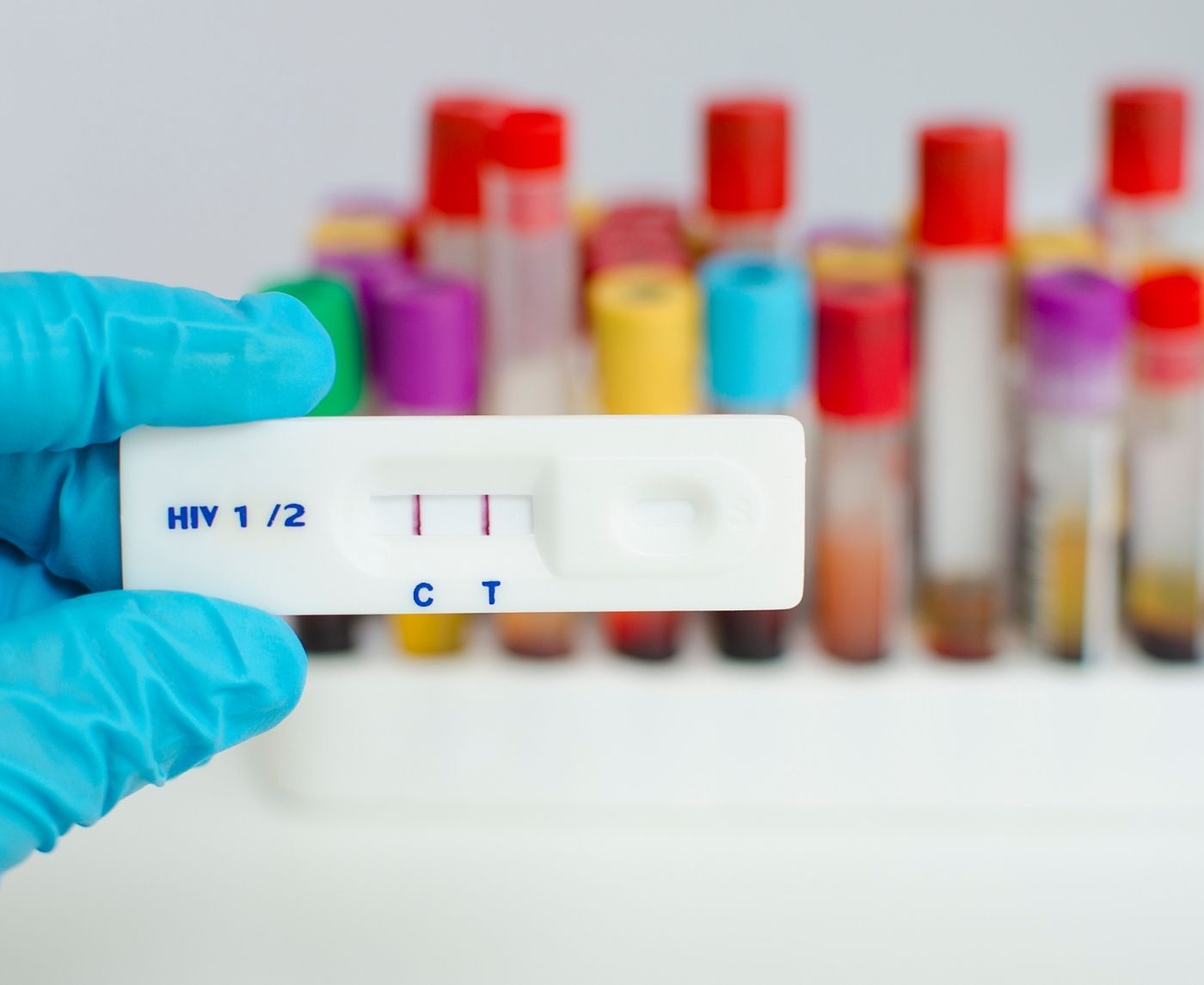 First Time Getting an STD Test? Here’s Exactly What to Expect