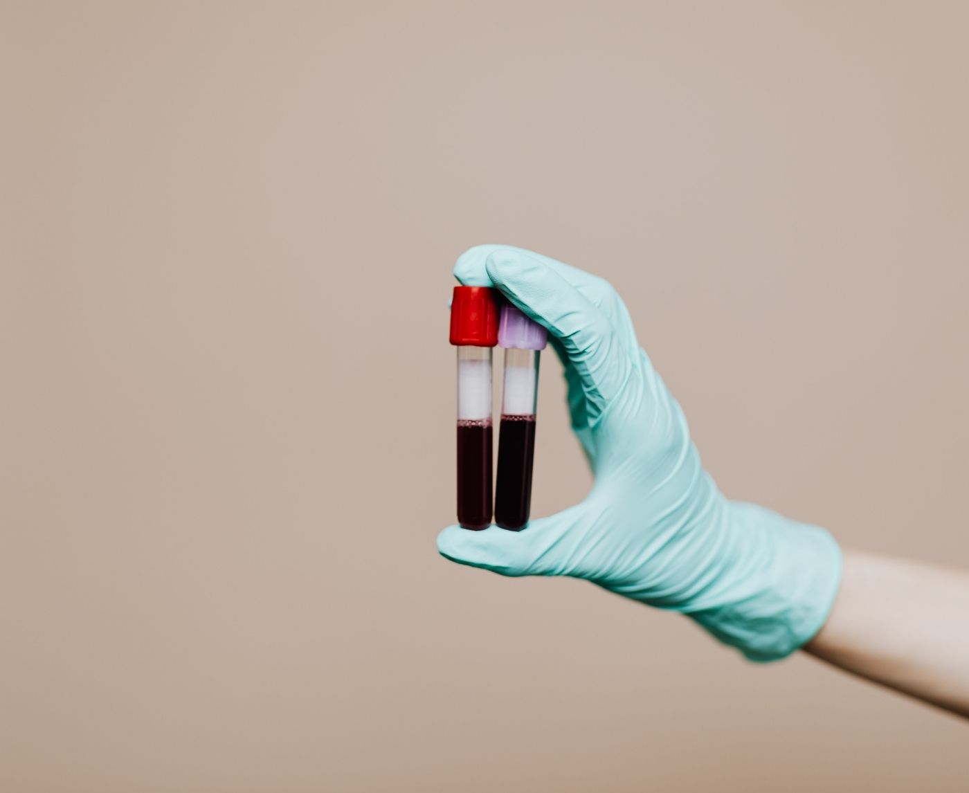 Faithful but Positive: When Gonorrhea Shows Up Anyway