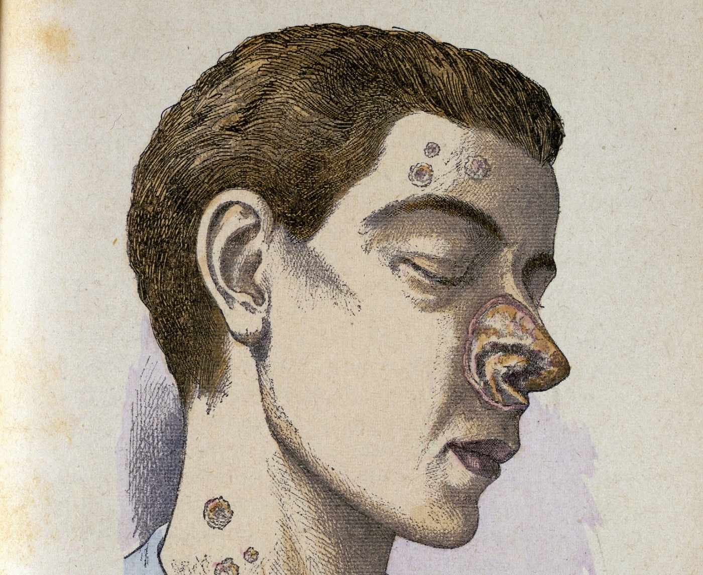 The History of STDs Is Weirder Than You Think