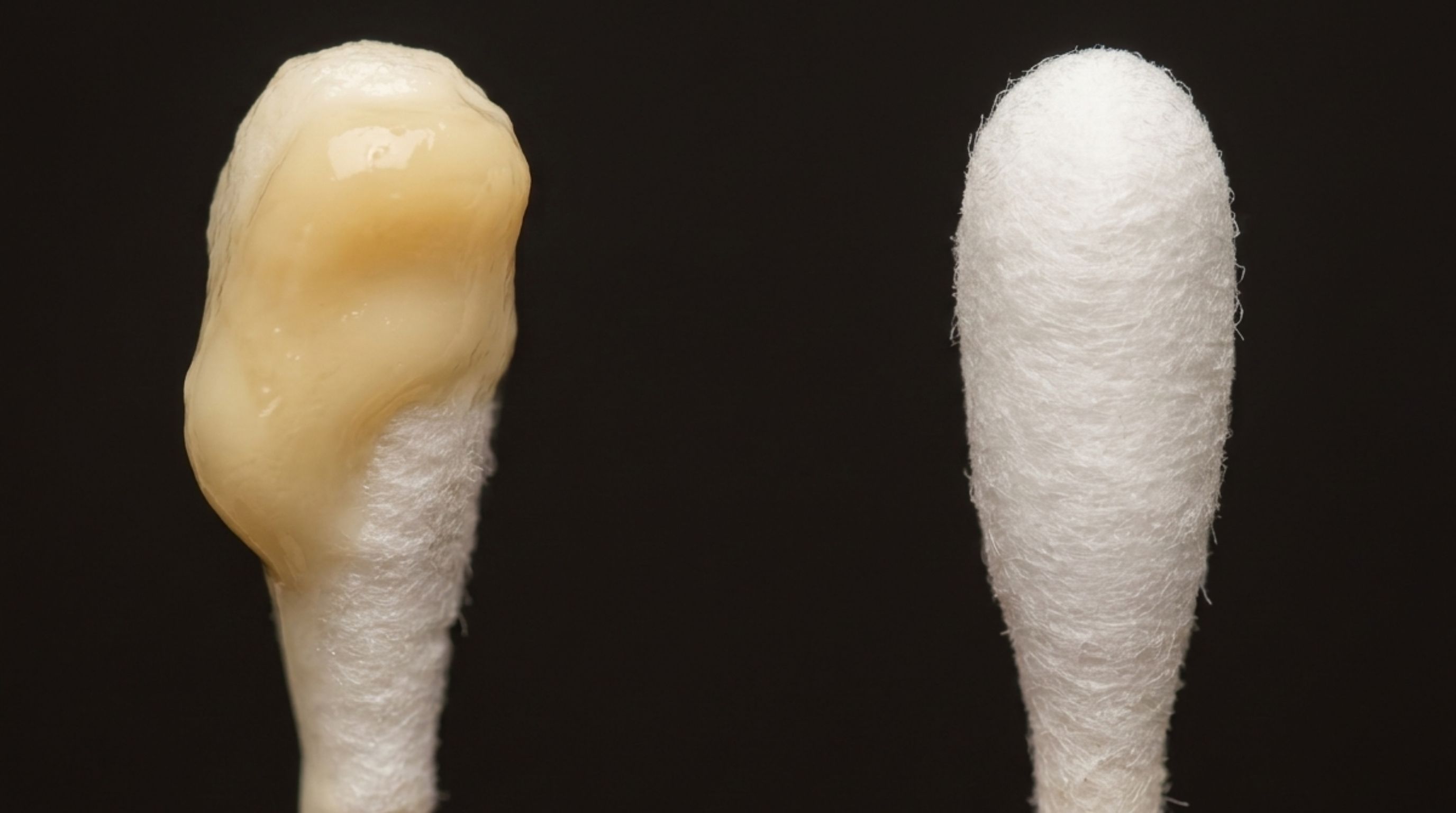 What Does Chlamydia Discharge Look Like in Men?