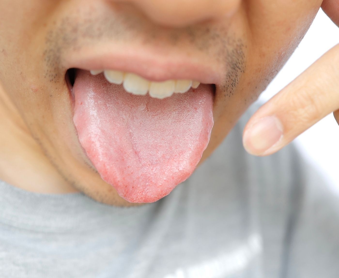 HPV and Throat Cancer: What a BBC Story Reveals About Early Warning Signs