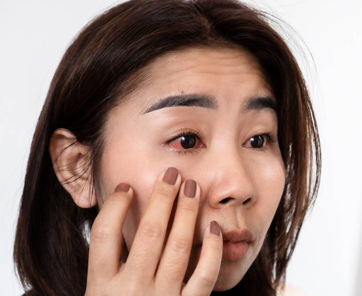 What Does Herpes in the Eye Look Like? A Symptom-by-Symptom Guide
