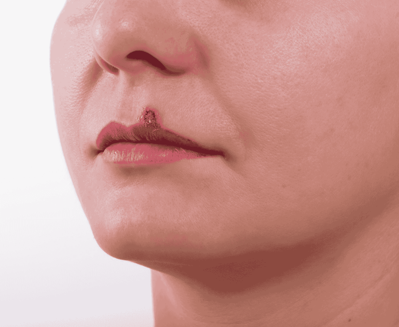 Why So Many People Have Herpes and Don’t Even Know