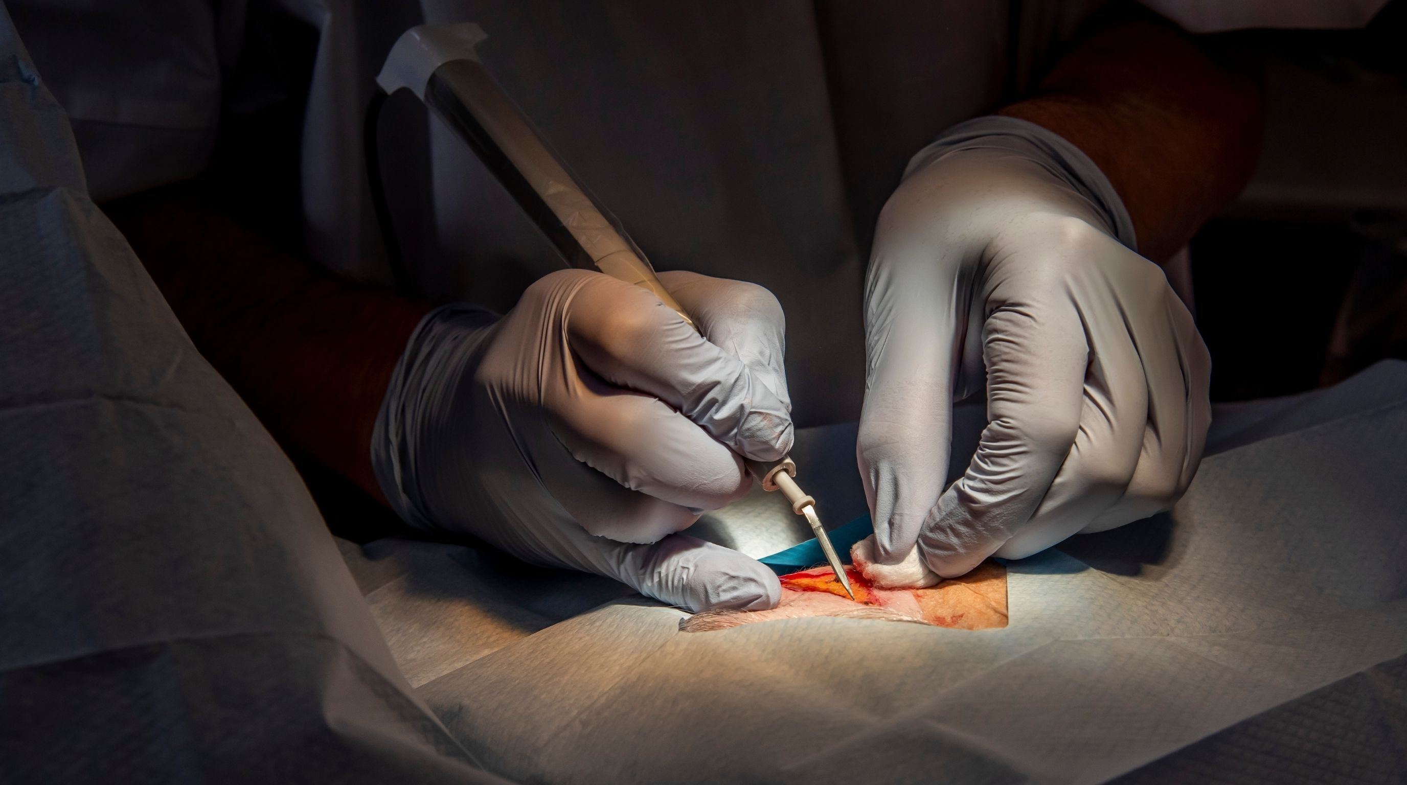 STD Symptoms After Vaginoplasty: What's Normal, What's Not, and When to Act
