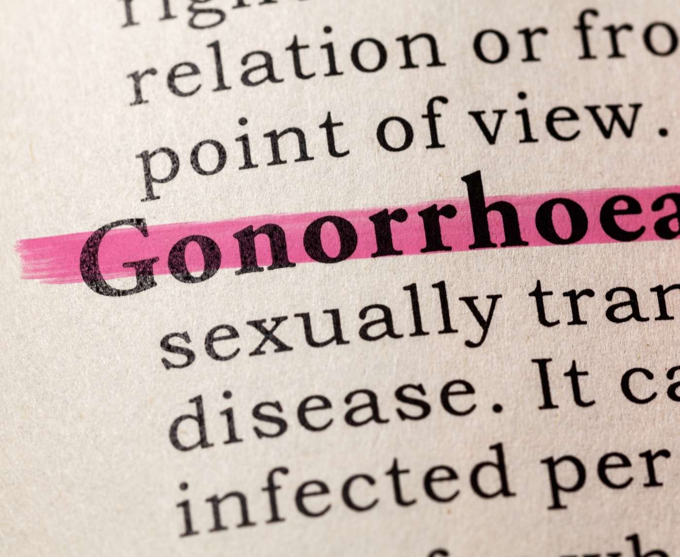 Gonorrhea Resistance and the Limits of DoxyPEP