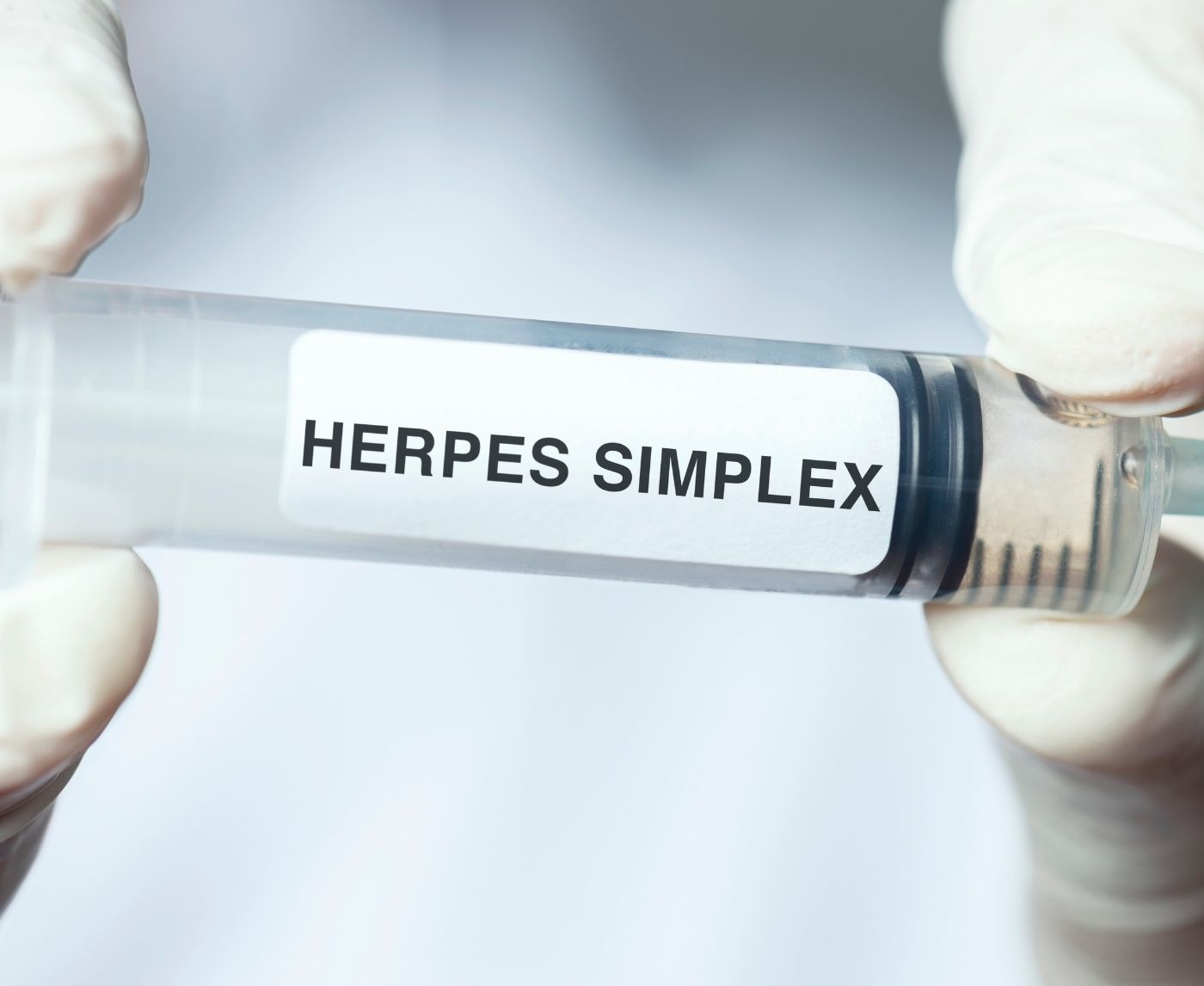 You Can Now Test for Herpes in Your Bedroom! (Here’s How It Works)
