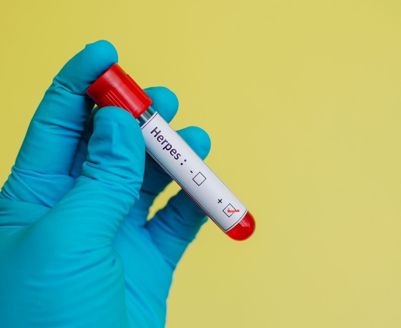 STD Again? Here’s Why It Happens, and What to Do About It