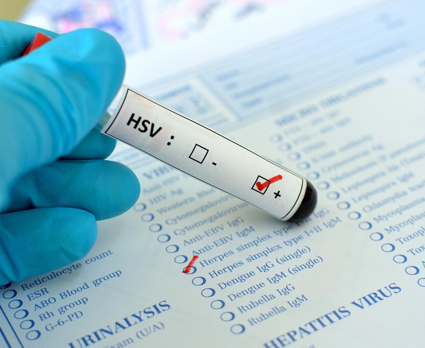 Tested Positive Without Having Sex? You’re Not Alone