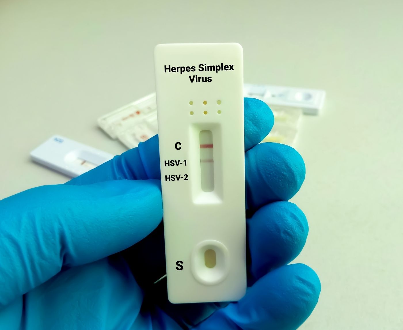 Herpes Symptoms but Negative Test? Read This First