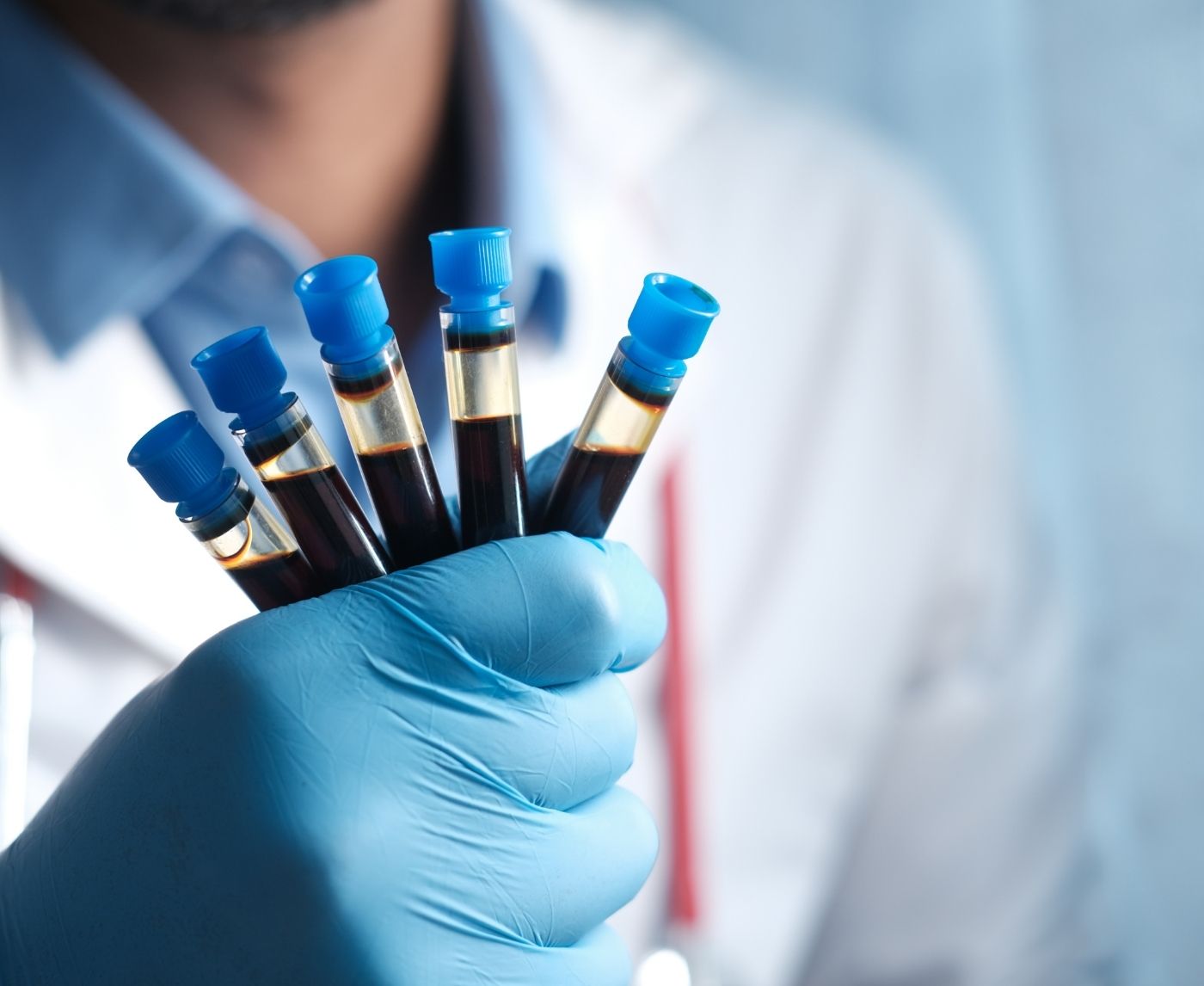 How Soon After Sex Can You Test for HSV-1 or HSV-2?