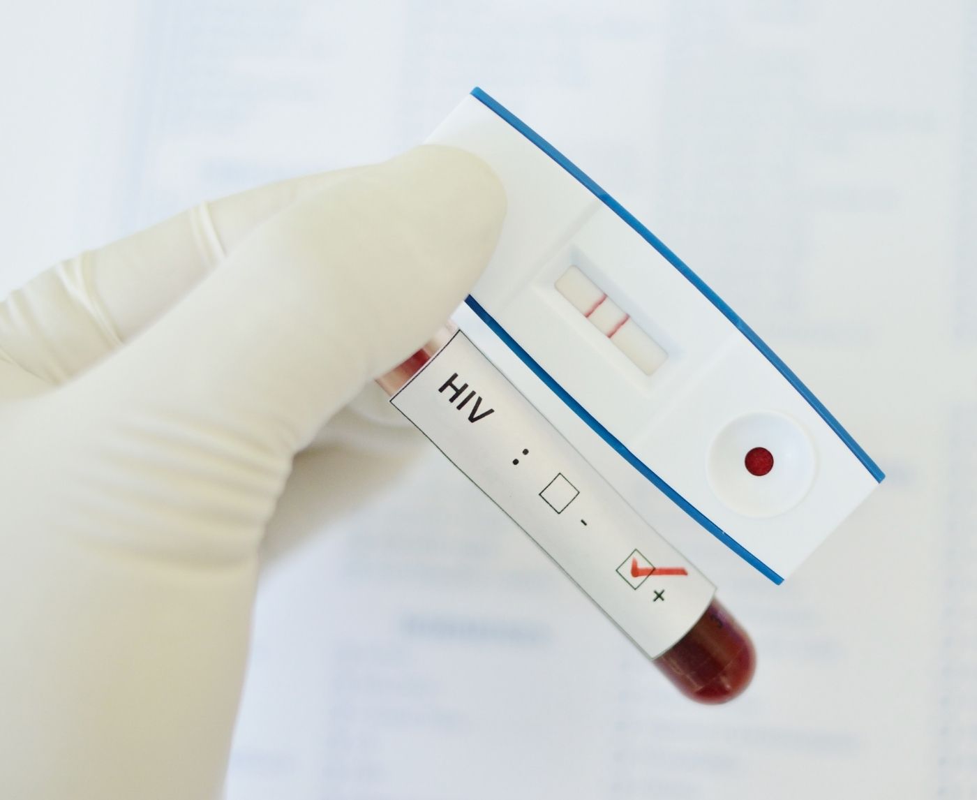 Got Tested Right After Sex? Here’s Why That Result Might Be Wrong