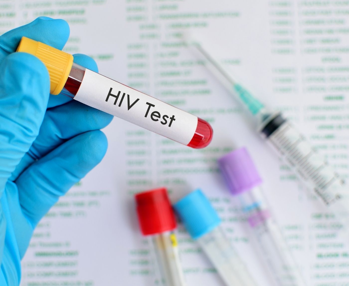 HIV Test Too Early? Here’s When to Test for Accurate Results