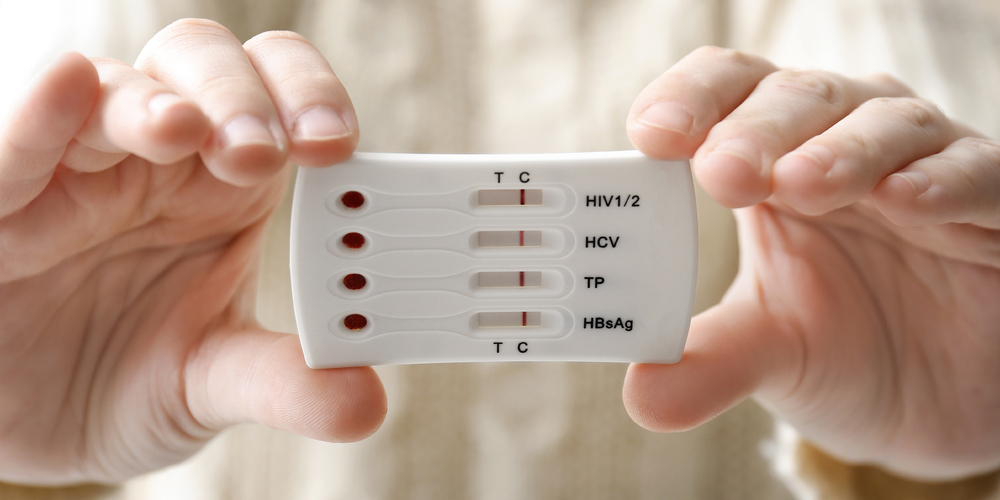 When the STD Test Says “Negative” But Your Body Says “Something’s Wrong”