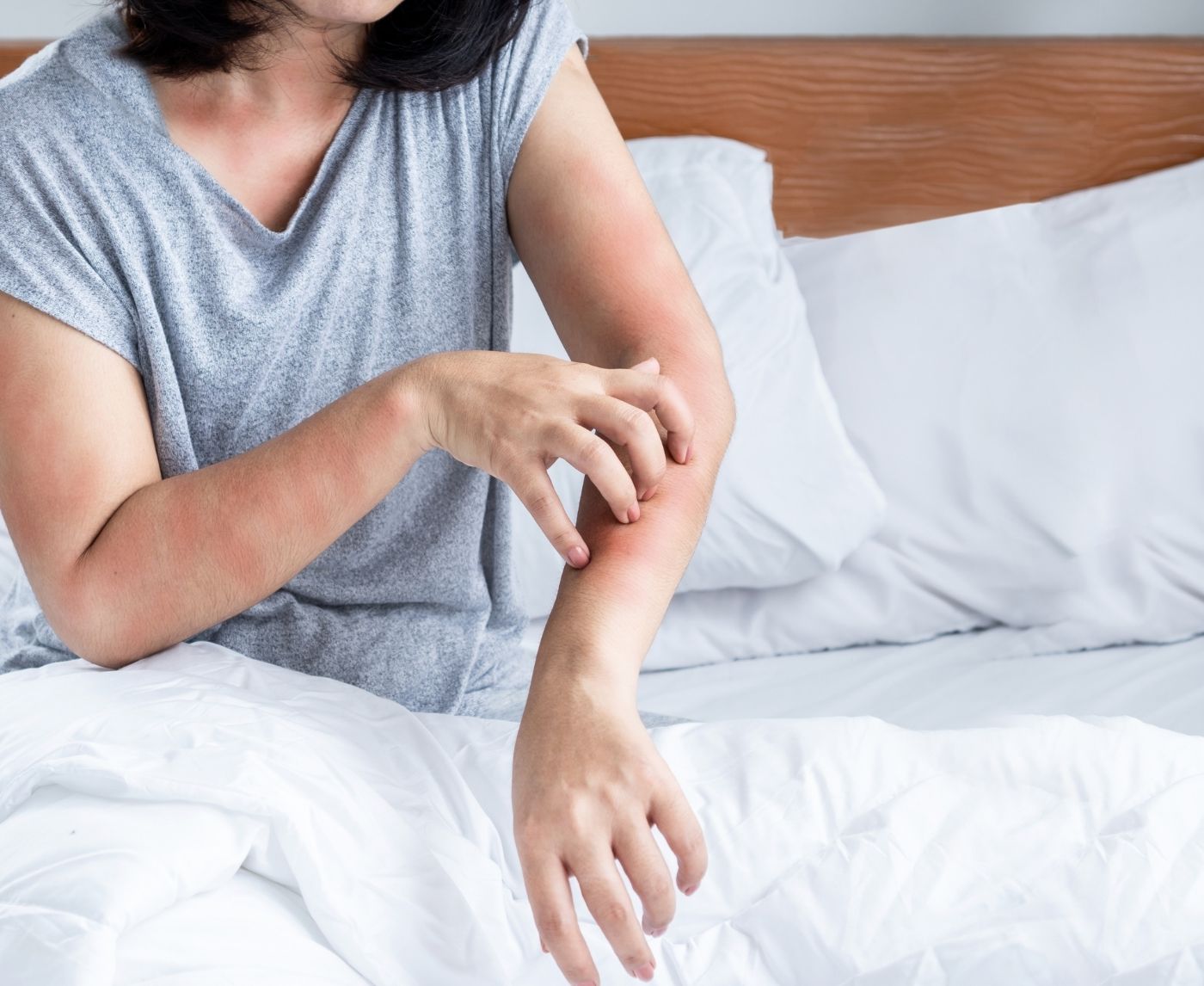 That Rash Isn’t Random: STD vs COVID Skin Symptoms Explained