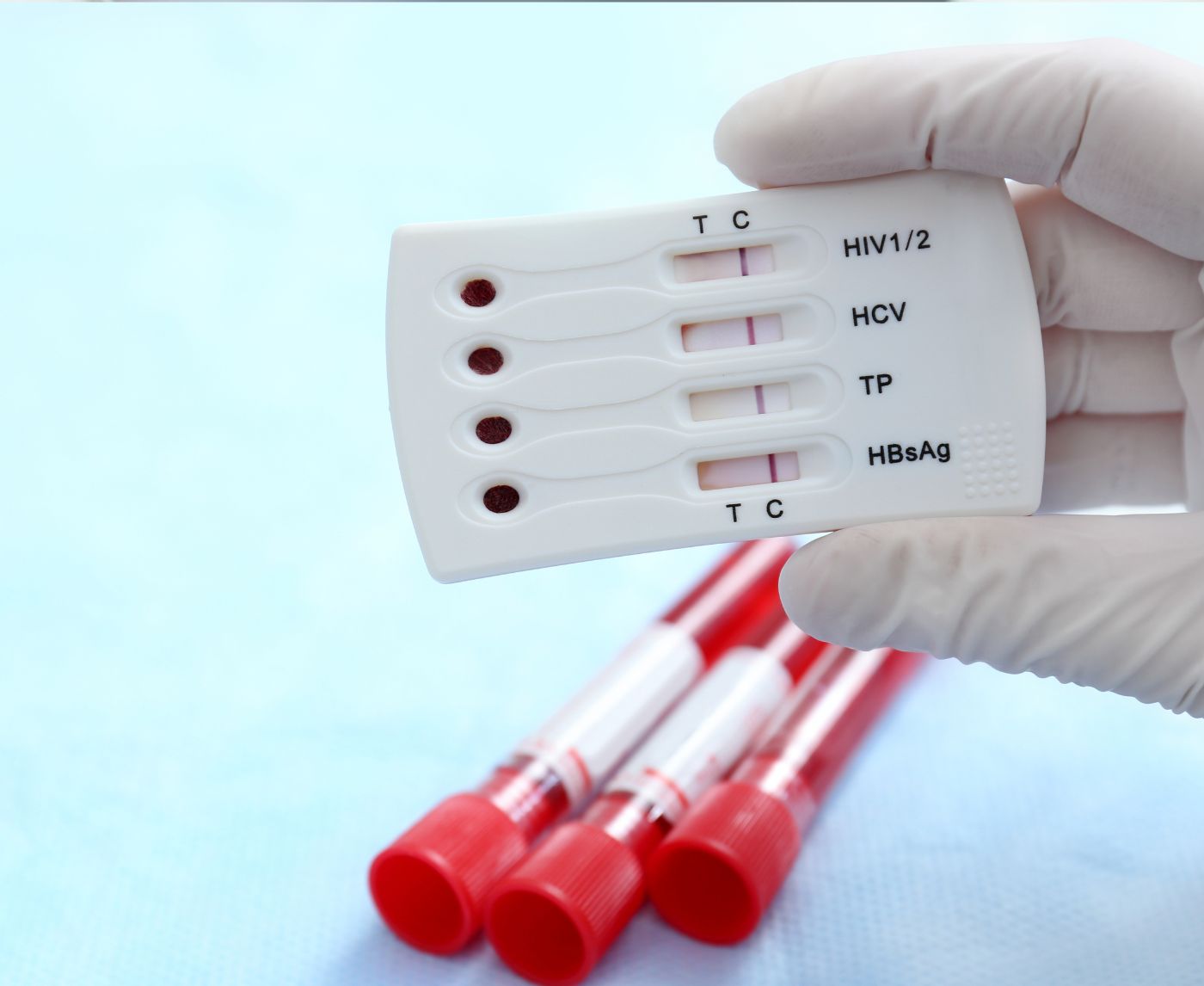 Think You Have HIV? Why Testing Too Early Can Backfire