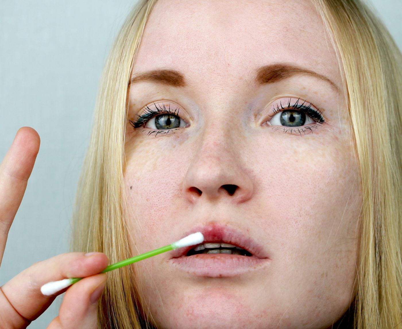 Yes, You Can Get Herpes Without Sex,Here’s How It Happens