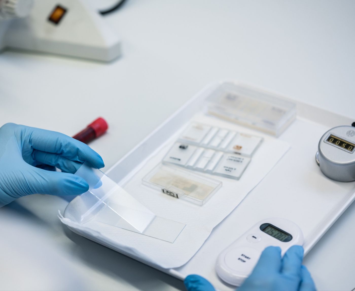 Why Your First STD Test Might Miss the Infection